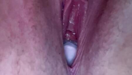 FtM Lays an Egg!!