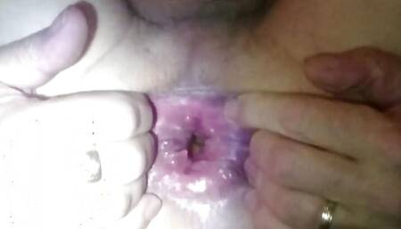 Birthing a big apple from my backhole. (anal apple ejection)