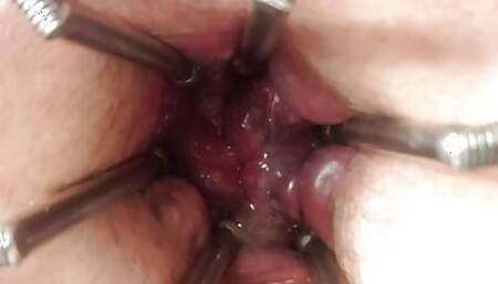 Opening my ass up with my expander toy
