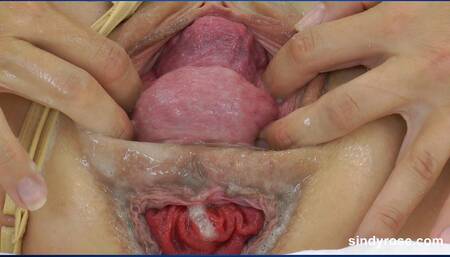 Sindy Rose self anal fisting & extreme prolapse on bed