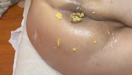 Analfoodie
