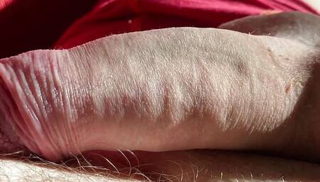 Dick