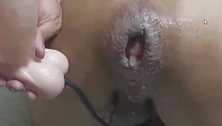 Anal extreme rosebud with big inflatable dildo