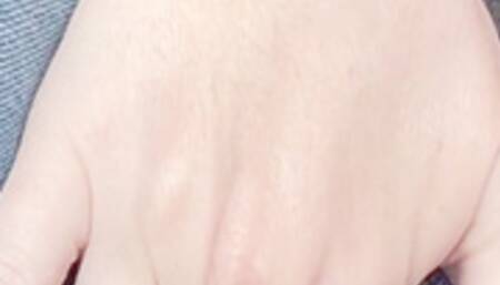 Lexi has a real accident