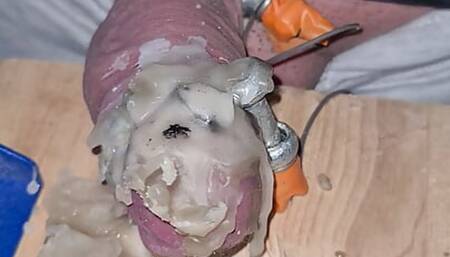 Tens and Hot wax