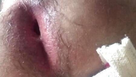 Amazing pink anal play gape hole.