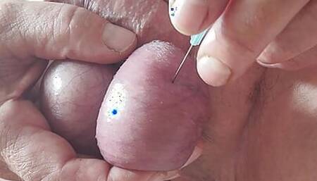 needles in testicles