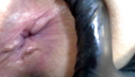Inspection of my ass in close-up
