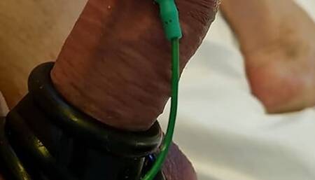 E-stim good