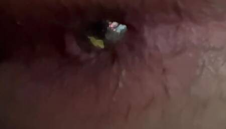 Anal
