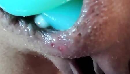 Asshole destruction and anal prolapse pulsation