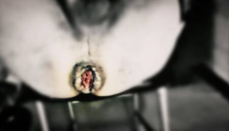 Anal destroy