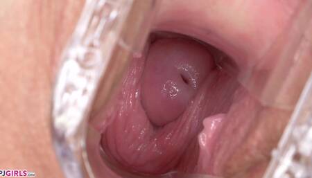 Speculum in motion