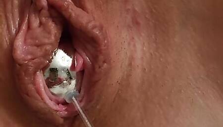 Vaginal balls