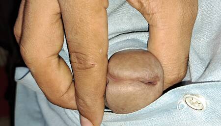 Uncut cock