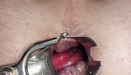 Anal gape and dumping 7 cum loads deep after spreading ass open with speculum