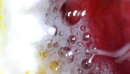 Full screen PillCam digestion of gummies 720HD