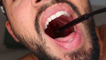 My first endoscopic mouth tour - Lalo Cortez