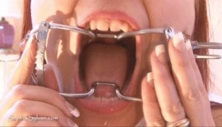 Look Deep into My Mouth- Dental Gag Closeups 480p mp4