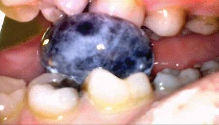 Sadie's Big Mouth Chewing and Swallowing From the Outside and the Inside