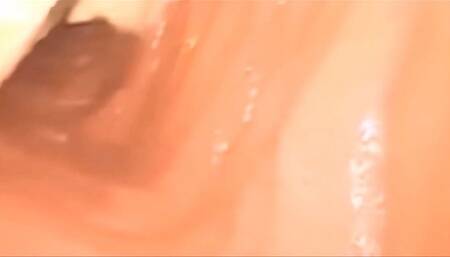 Very problematic medical vore anal exploration 720HD