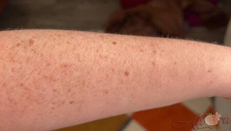 Arm Hair 2 (wmv)