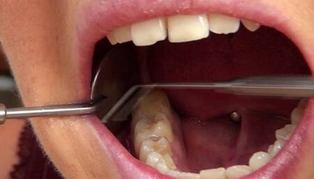 The Dentist Tool 2 HD-720