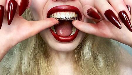 Orthodontic Cap & Spitting