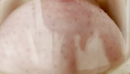 Nipple sucker
