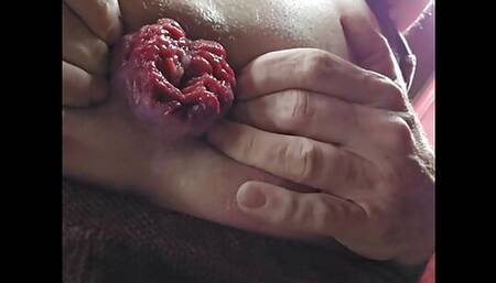 Small Prolapse gaping rosebud at work