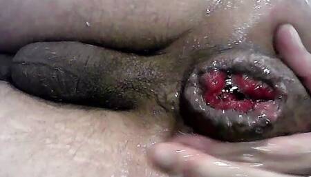 Destroying my ass again episode of anal prolapse series ASS P1