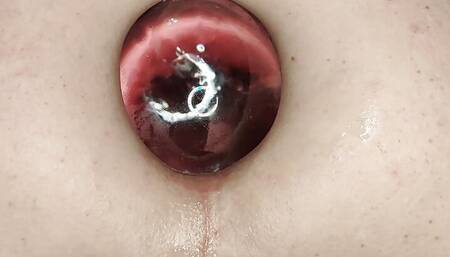 Just a Gaping Hole Ft David Anderson
