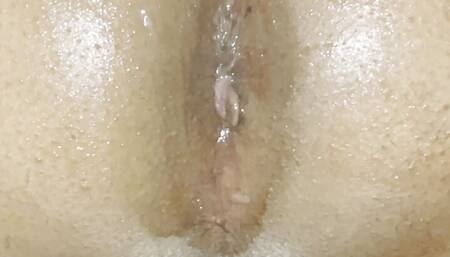 My arsehole being teased