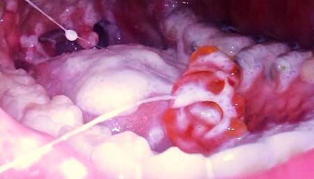 CUSTOM Tiny Spy in My Food