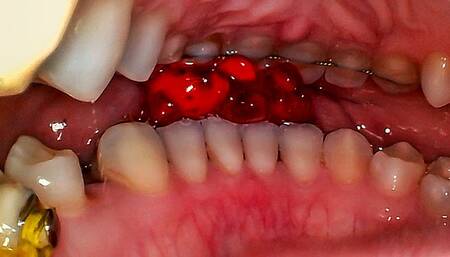 Reverse Gummy Bears Play