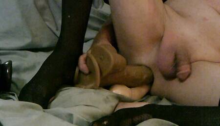 extreme anal stretching