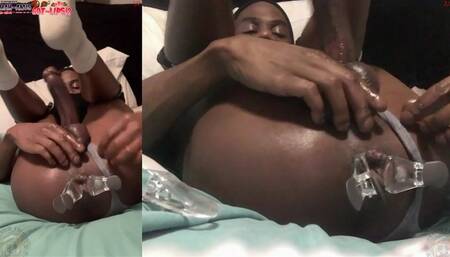 Growing Asslips Dual Angle 1and2 - My Daily Asshole BDSM Exercise