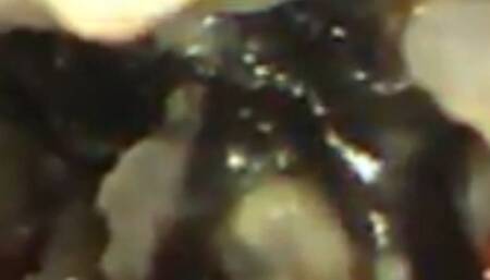 Vore Digestion Sushi Restaurant Video - Full Exploration Pillcam Video 720HD