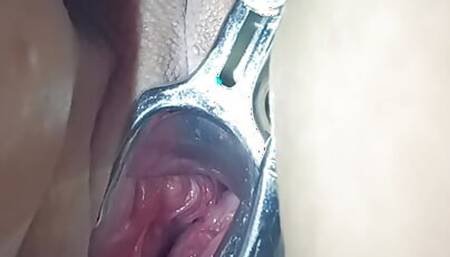My hot wife's pussy is spread wide open by a speculum.