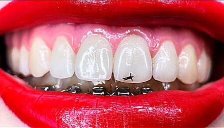 Punishing My Tiny Servant CUSTOM