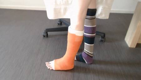 I Am Showing You My Leg in a Cast From All Sides