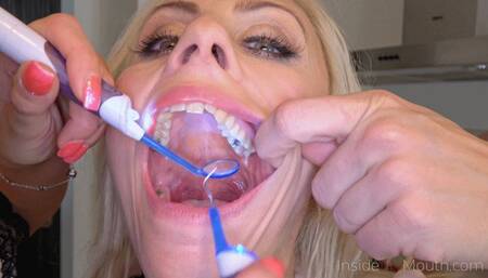 Inside My Mouth - Silvia and Brittany have a dental checkup (MOBILE)