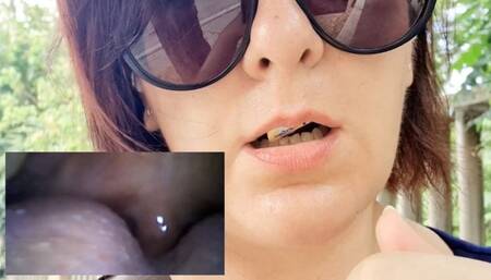 MiroCam new Vore exploration with medical PillCam in outdoor 1080HD