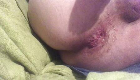 My pulled ass????