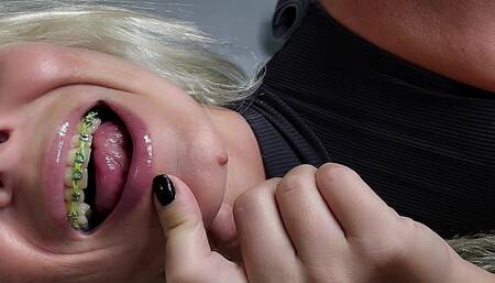 Licking And Sucking My Metal Braces/Anal Plug POV