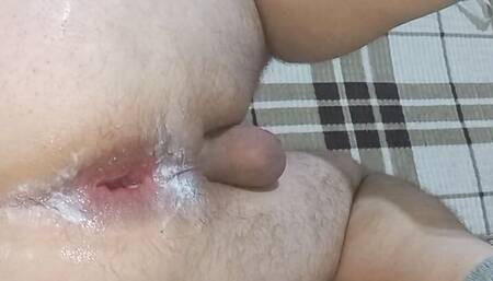 7.5cm. hole expansion