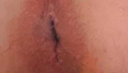 AndersAnal