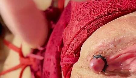 Look! The Cunt of genital plastic surgery and labia minora resection.Big clit tease.