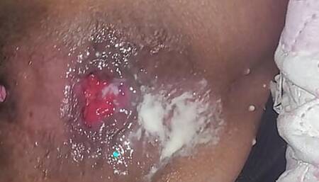 Maid does very open anal prolapse