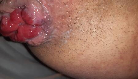 My prolapse twink boy hole
